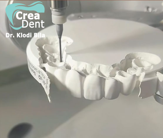 Fresatori cad/cam