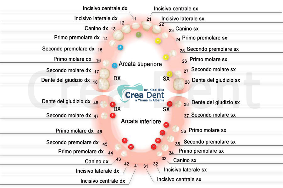 Schema dei ponti cementati sui denti